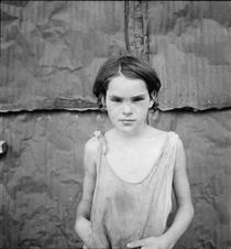 Damaged Child, Shacktown, Elm Grove, Oklahoma - Dorothea Lange
